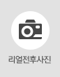 전후사례